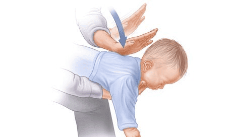 Cách xử lý khi trẻ sơ sinh bị sặc sữa lên mũi