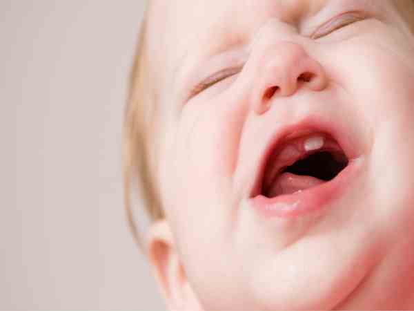 Răng cửa trên (8-12 tháng tuổi) Răng cửa trên (8-12 tháng tuổi)