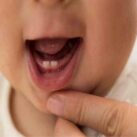 trẻ mọc răng nào trước