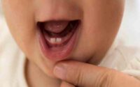 trẻ mọc răng nào trước