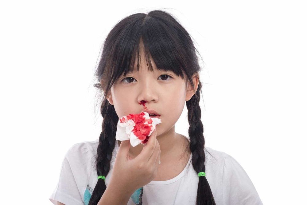 Nguyên nhân gây chảy máu cam ở trẻ em