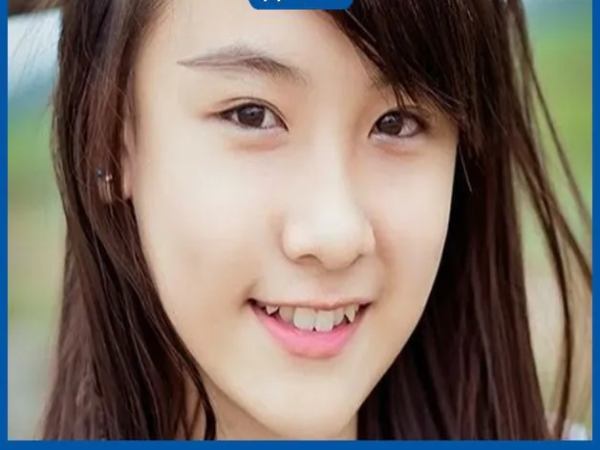 Vận mệnh nữ giới răng chó